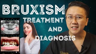 Teeth Grinding when sleeping Bruxism  Symptoms Treatment amp Diagnosis [upl. by Gavrila]