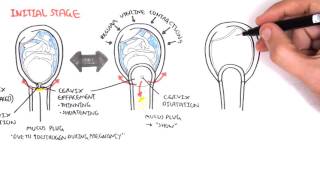 Obstetrics  Stage I of Labour [upl. by Asyral]