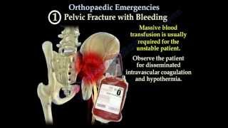 Nerve Injury  Nerve Damage  ANIMATION  Neuron  The Young Orthopod [upl. by Engleman]