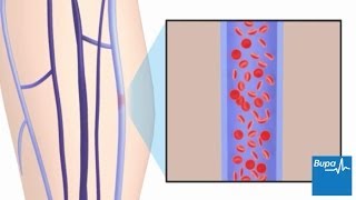 Doppler Ultrasound Arteries vs Veins [upl. by Sabina]