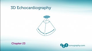 3D Echocardiography Explanation and Demonstration of Echocardiogram [upl. by Dory]