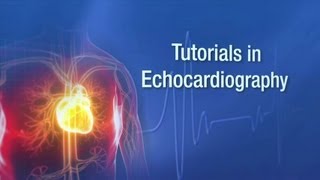 Echo Assessment for MitraClip [upl. by Hannover81]