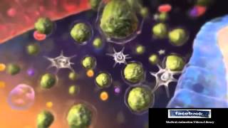 Acute Lymphocytic Leukemia ALL Animation [upl. by Aaronson604]