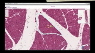 Histology Helper  Muscle Histology [upl. by Gearhart530]