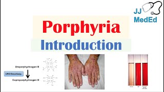 Introduction to Porphyria  Porphyria Cutanea Tarda vs Acute Intermittent Porphyria [upl. by Lewls]