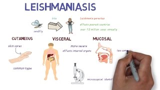 What is Leishmaniasis An introduction and overview [upl. by Ikkaj778]