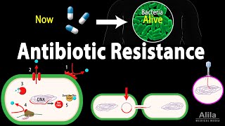 Antibiotic Resistance Animation [upl. by Nael]