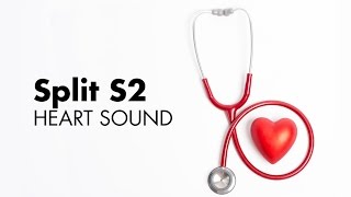 Fixed Split S2  Heart Sounds  MEDZCOOL [upl. by Ailugram]