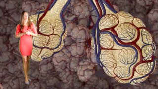 Emphysema amp Bronchitis COPD [upl. by Eldwin]