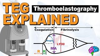 TEG Explained  Understanding the Thromboelastography [upl. by Dachi]