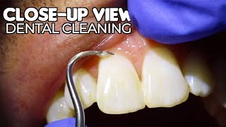 Dental Cleaning  CloseUp View ASMR [upl. by Mharba]