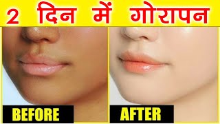 2 दिन में गोरा होने का तरीका Gharelu Nuskhe Se Gori Hone Ka Tarika जानिए गोरा होने के उपाय Fair Skin [upl. by Asfah]