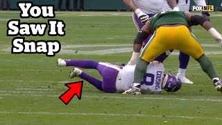 Kirk Cousins Ruptures His Achilles  Doctor Explains [upl. by Grizel]