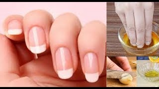 ASTUCE FAIRE POUSSER SES ONGLES PLUS VITE [upl. by Enyamert]