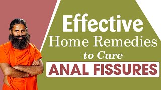 Effective Home Remedies To Cure Anal Fissures  Swami Ramdev [upl. by Egbert]