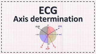 Cardiac Axis Determination  ECG Axis  Simplified [upl. by Thanasi]