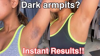 How To Get Rid Of Dark Armpits INSTANTLY 100 works [upl. by Dnomasor392]