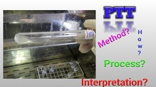 Prothrombin Time Test PT Hematology [upl. by Ahtel]