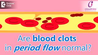 Why does menstrual bleeding have blood clots Is it normalDrShalini Varma of Cloudnine Hospitals [upl. by Aivitnahs]