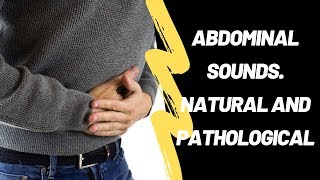 Abdominal Sounds Natural And Pathological [upl. by Tabitha]