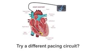 Pacing Guide What is it [upl. by Attekal]