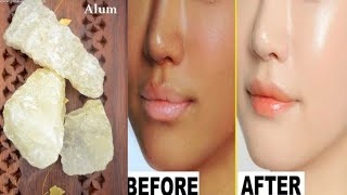 How To Remove Tanning Just In 20 Minutes  Instant whitening Formula Get Glowing Shiny Korean Skin [upl. by Ahsiele38]