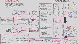 Liver Cirrhosis SandS Pathophysiology Investigations Management [upl. by Nero178]