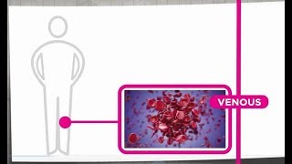 Venous Thrombosis Explained [upl. by Rafter]