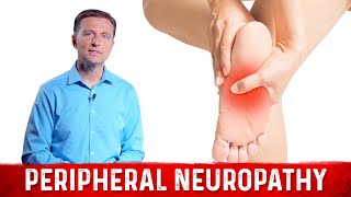 Peripheral Neuropathy Home Remedies Leg amp Foot Nerve Pain Treatment [upl. by Idnod]