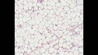 Shotgun Histology Adipose Tissue [upl. by Traggat]