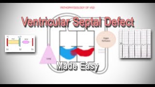 CNS Pharmacology Ar  Lec 08 Therapy of epilepsy Part 1 Pathophysiology and clinical aspects [upl. by Ysnat756]