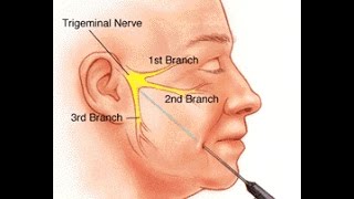 Pudendal Neuralgia Treatment  Los Angeles  Dr Michael Tahery [upl. by Tolman485]