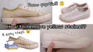 How to remove yellow stains on white shoes 4 Easy Steps [upl. by Lillis170]