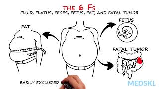 Abdominal Distension The 6 Fs that can help your diagnosis [upl. by Juana33]