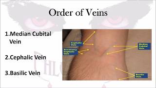 Understanding and Diagnosing Venous Thromboembolism VTE [upl. by Wilmott885]