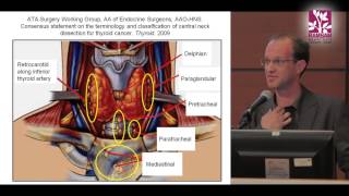 Breast Carcinoma in situ  Pathology mini tutorial [upl. by Koffman199]