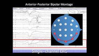 Introduction to EEG [upl. by Suiratnauq]