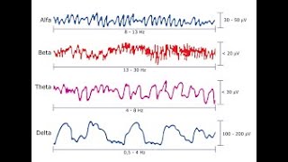 Electroencefalograma [upl. by Marji471]