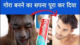 गोरा होने का तरीका Skin Whitening  Gora Hone Ka Tarika  Rang Gora Karne Ke Gharelu Upay [upl. by Arelus123]