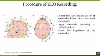 2Minute Neuroscience Electroencephalography EEG [upl. by Toland]