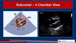 HOW TO READ AN ECG WITH ANIMATIONSin 10 mins [upl. by Anilev]