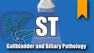 Radiological anatomy episode 4 Biliary system Anatomy [upl. by Vilberg]