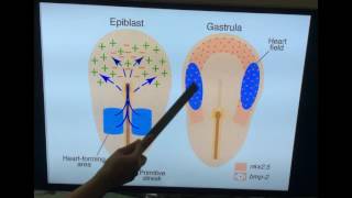 Patent Ductus Arteriosus normal speed [upl. by Fennell]