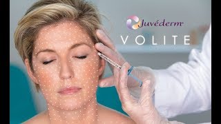 How to hydrate your skin from the inside out with Juvederm Volite at BC laser [upl. by Pollux]