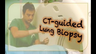 CT lung nodule assessment  how to assess them  basics [upl. by Fari]