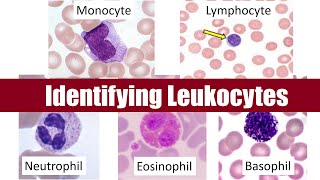 Identifying Leukocytes [upl. by Ahsienyt778]