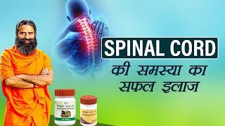 Ayurvedic Treatment for Spinal Cord  Swami Ramdev [upl. by Haliehs258]