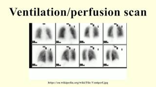 Elements of Ventilation Systems [upl. by Atcliffe656]