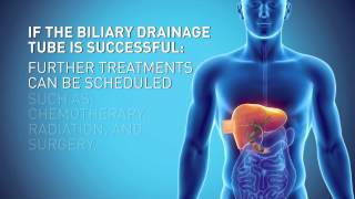 Biliary Drain [upl. by Julie]