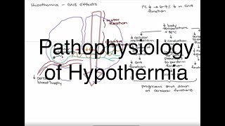 Hypothermia Pathophysiology [upl. by Moritz]